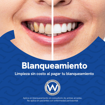 Slider image (10) DrAW Dental Clinic